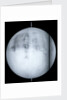 Globe x-ray by Guillaume de L'Isle