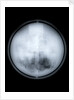 Globe x-ray by Charles Price
