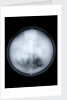 Globe x-ray by Charles Price