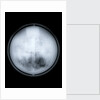 Globe x-ray by Charles Price
