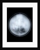 Globe x-ray by Charles Price