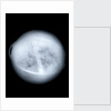 Globe x-ray by Charles Price