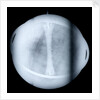 Globe x-ray by Jacques de La Feuille