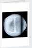 Globe x-ray by Jacques de La Feuille