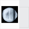 Globe x-ray by Jacques de La Feuille