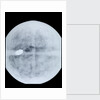 Globe x-ray by Jodocus Hondius