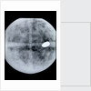 Globe x-ray by Jodocus Hondius