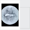 Globe x-ray by Jodocus Hondius