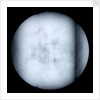 Globe x-ray by Robert Morden
