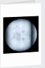 Globe x-ray by Robert Morden