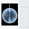 Globe x-ray by William Bardin