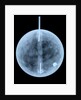 Globe x-ray by William Bardin