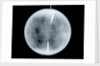 Globe x-ray by Dudley Adams