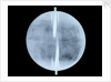 Globe x-ray by Thomas Patrick
