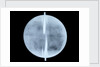 Globe x-ray by Thomas Patrick