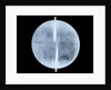 Globe x-ray by Thomas Patrick