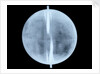 Globe x-ray by Thomas Patrick