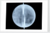 Globe x-ray by Thomas Patrick