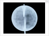 Globe x-ray by Thomas Patrick