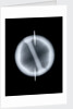 Globe x-ray by Joannes Oterschaden