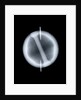 Globe x-ray by Joannes Oterschaden