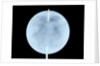 Globe x-ray by John Cary