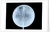 Globe x-ray by John Cary