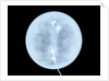 Globe x-ray by West