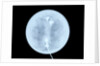 Globe x-ray by West
