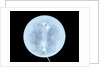 Globe x-ray by West