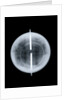 Globe x-ray by West