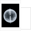 Globe x-ray by West