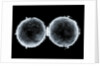 Globe x-ray by West