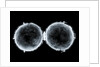 Globe x-ray by West