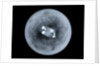 Globe x-ray by Charles Price