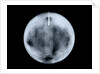 Globe x-ray by George Adams