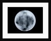 Globe x-ray by George Adams