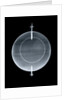 Globe x-ray by Jean Fortin