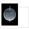 Globe x-ray by Jean Fortin
