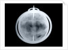 Globe x-ray by John Senex
