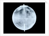 Globe x-ray by Dudley Adams