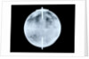 Globe x-ray by Dudley Adams