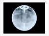 Globe x-ray by Dudley Adams