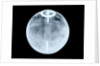 Globe x-ray by Dudley Adams