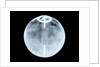 Globe x-ray by Dudley Adams