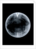 Globe x-ray by Richard Cushee