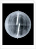Globe x-ray by Newton & Co.