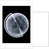 Globe x-ray by Newton Son & Berry