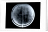Globe x-ray by Johann Gabriel Doppelmayr