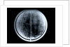 Globe x-ray by Johann Gabriel Doppelmayr